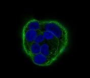 IF/ICC staining of human HaCaT cells with Cytokeratin antibody (green) and DAP nuclear stain (blue).