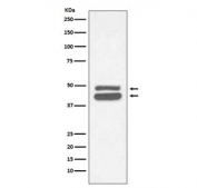 Western blot testing of human HeLa cell lysate with CK18 antibody. Predicted molecular weight ~48 kDa.