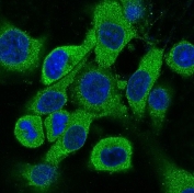 IF/ICC staining of rat PC-12 cells with CK18 antibody (green) and DAP nuclear stain (blue).