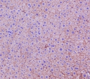 IHC staining of FFPE mouse liver tissue with CK18 antibody. HIER: boil tissue sections in pH6, 10mM citrate buffer, for 10-20 min and allow to cool before testing.