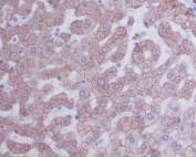 IHC staining of FFPE human human liver with Keratin 8 antibody. HIER: boil tissue sections in pH6, 10mM citrate buffer, for 10-20 min and allow to cool before testing.