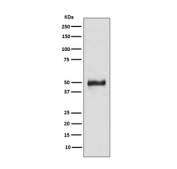Western blot testing of human HaCat cell lysate with Keratin 8 antibody. Predicted molecular weight ~56 kDa.