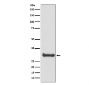 Western blot testing of human fetal brain lysate with Calbindin antibody. Predicted molecular weight: 27-28 kDa.