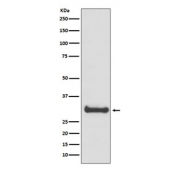 Western blot testing of human fetal brain lysate with Calbindin antibody. Predicted molecular weight: 27-28 kDa.