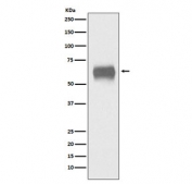 Western blot testing of human plasma lysate with CD5 antibody. Observed molecular weight: 55~67 kDa depending on glycosylation level.