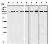 Western blot testing of 1) mouse liver, 2) mouse spleen, 3) mouse lung, 4) mouse kidney, 5) mouse skin, 6) rat liver, 7) rat spleen, 8) rat lung and 9) rat brain tissue lysate with Insulin Receptor antibody. Expected molecular weight: ~156 kDa (precursor), ~95 kDa (b-subunit).