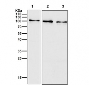 Western blot testing of human 1) HeLa, 2) HepG2 and 3) MCF7 cell lysate with Insulin Receptor antibody. Expected molecular weight: ~156 kDa (precursor), ~95 kDa (b-subunit).