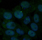 Immunofluorescent staining of FFPE human BxPC-3 cells with Insulin Receptor antibody (green) and DAPI nuclear stain (blue). HIER: steam section in pH6 citrate buffer for 20 min.