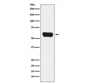 Western blot testing of human Jurkat cell lysate with LCK antibody. Predicted molecular weight ~58 kDa.