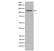 Western blot testing of lysate from human Jurkat cells treated with Alkaline Phosphatase, with Retinoblastoma antibody. Predicted molecular weight ~110 kDa.