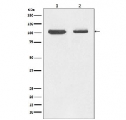 Western blot testing of human 1) Jurkat and 2) MCF7 cell lysate with Rb1 antibody. Predicted molecular weight ~110 kDa.