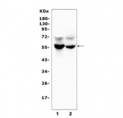 Western blot testing of human 1) placenta and 2) PC-3 lysate with GLUT6 antibody. Predicted molecular weight ~55 kDa.