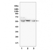 Western blot testing of rat 1) liver, 2) kidney and 3) lung tissue lysate with GLUT6 antibody. Predicted molecular weight ~55 kDa.