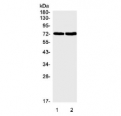 Western blot testing of human 1) HL-60 and 2) ThP-1 cell lysate with SGLT2 antibody. Predicted molecular weight ~73 kDa.