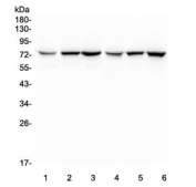 Western blot testing of 1) rat kidney, 2) rat spleen, 3) rat lung, 4) mouse kidney, 5) mouse spleen and 6) mouse lung lysate with SGLT2 antibody. Predicted molecular weight ~73 kDa.
