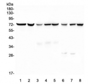 Western blot testing of 1) human HL-60, 2) human ThP-1, 3) rat kidney, 4) rat spleen, 5) rat lung, 6) mouse kidney, 7) mouse spleen and 8) mouse lung lysate with SGLT2 antibody. Predicted molecular weight ~73 kDa.