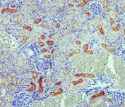 IHC staining of FFPE rat kidney with SGLT2 antibody. HIER: boil tissue sections in pH6, 10mM citrate buffer, for 20 min and allow to cool before testing.