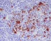 IHC staining of FFPE rat spleen tissue with phospho-CDK1/2 antibody (pT14). HIER: boil tissue sections in pH6, 10mM citrate buffer, for 10-20 min and allow to cool before testing.
