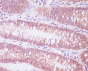 IHC staining of FFPE human colon tissue with Alpha Enolase antibody. HIER: boil tissue sections in pH6, 10mM citrate buffer, for 10-20 min and allow to cool before testing.