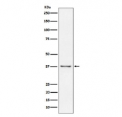 Western blot testing of human Raji cell lysate with CD23 antibody. Expected molecular weight: 37-45 kDa.