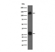 Western blot testing of human A549 cell lysate with Integrin alpha V antibody. Expected molecular weight: 116-150 kDa.