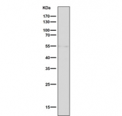 Western blot testing of human SK-BR-3 cell lysate with Tyrosine Hydroxylase antibody. Predicted molecular weight: 55-60 kDa.