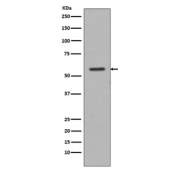 Western blot testing of human PC-3 cell lysate with Tyrosine Hydroxylase antibody. Predicted molecular weight: 55-60 kDa.