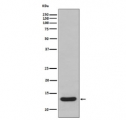 Western blot testing of human fetal liver lysate with FABP1 antibody. Predicted molecular weight ~14 kDa.