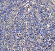 IHC staining of FFPE human spleen tissue with GPX1 antibody. HIER: boil tissue sections in pH8 EDTA for 20 min and allow to cool before testing.