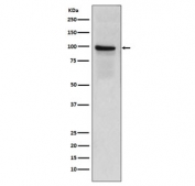 Western blot testing of human placenta lysate with CD141 antibody. Expected molecular weight: 60-100 kDa depending on glycosylation.