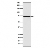 Western blot testing of human fetal kidney lysate with Calpain 1 antibody. Predicted molecular weight ~82 kDa.