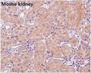 IHC staining of FFPE mouse kidney with Beta Tubulin antibody. HIER: boil tissue sections in pH6, 10mM citrate buffer, for 10-20 min and allow to cool before testing.