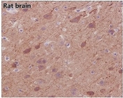 IHC staining of FFPE rat brain with Beta Tubulin antibody. HIER: boil tissue sections in pH6, 10mM citrate buffer, for 10-20 min and allow to cool before testing.