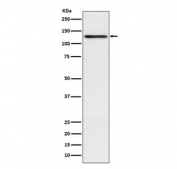Western blot testing of human A431 cell lysate with Involucrin antibody. Predicted molecular weight ~68 kDa but can be observed at up to ~140 kDa.