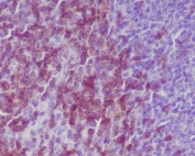 IHC staining of FFPE mouse spleen tissue with CD3e antibody. HIER: boil tissue sections in pH6, 10mM citrate buffer, for 10-20 min and allow to cool before testing.