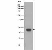 Western blot testing of human Jurkat cell lysate with CD3 epsilon antibody. Predicted molecular weight ~23 kDa.