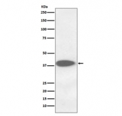 Western blot testing of human A375 cell lysate with CTSB antibody. Molecular weight: 38-46 kDa depending on glycosylation level. An ~31 kDa form (propeptide removed) may be observed and may be further processed into an ~25 kDa heavy chain and ~5 kDa light chain.