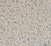 IHC staining of FFPE rat brain tissue with HSP90 alpha/beta antibody. HIER: boil tissue sections in pH8 EDTA for 20 min and allow to cool before testing.