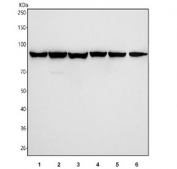 Western blot testing of 1) human 293T, 2) human U-251, 3) human SiHa, 4) rat brain, 5) mouse brain and 6) mouse kidney tissue lysate with HSP90 alpha/beta antibody. Predicted molecular weight: 84-90 kDa.