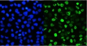 Immunofluorescent staining of FFPE human A431 cells with SMARCAD1 antibody (green) at 2ug/ml and DAPI nuclear stain (blue). HIER: steam section in pH6 citrate buffer for 20 min.