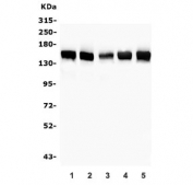 Western blot testing of 1) rat testis and mouse 2) thymus, 3) lung, 4) testis and 5) kidney tissue lysate with SMARCAD1 antibody. Predicted molecular weight ~117 kDa but can be observed at up to ~150 kDa.