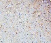 IHC staining of FFPE mouse brain with SMARCAD1 antibody. HIER: boil tissue sections in pH6, 10mM citrate buffer, for 20 min and allow to cool before testing.