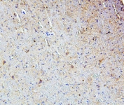 IHC staining of FFPE mouse brain with SMARCAD1 antibody. HIER: boil tissue sections in pH6, 10mM citrate buffer, for 20 min and allow to cool before testing.