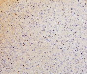 IHC staining of FFPE rat brain with SMARCAD1 antibody. HIER: boil tissue sections in pH6, 10mM citrate buffer, for 20 min and allow to cool before testing.