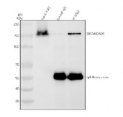 Immunoprecipitation of SMARCAD1 protein from 500ug of human K562 whole cell lysate with 2ug of SMARCAD1 antibody.