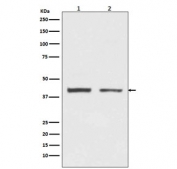 Western blot testing of human 1) HeLa and 2) HepG2 cell lysate with HNRNPC antibody. Expected molecular weight ~41 kDa (C1) and ~43 kDa (C2).