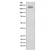 Western blot testing of human SH-SY5Y cell lysate with c-Ret antibody. Expected molecular weight: 150, 170 kDa.