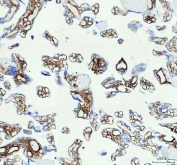 IHC staining of FFPE human placental tissue with Collagen I antibody. HIER: boil tissue sections in pH8 EDTA buffer, for 10-20 min and allow to cool before testing.
