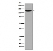 Western blot testing of human stomach lysate with Collagen I antibody. Expected molecular weight: 100-140 kDa.