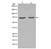 Western blot testing of rat 1) C6 and 2) PC-12 cell lysate with p75NTR antibody. Expected molecular weight: 45-75 kDa depending on glycosylation level.